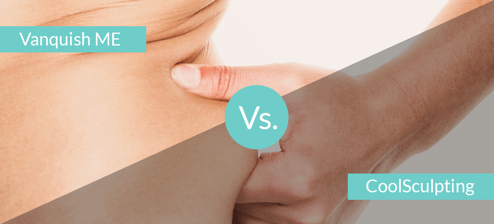 vanquish coolsculpting